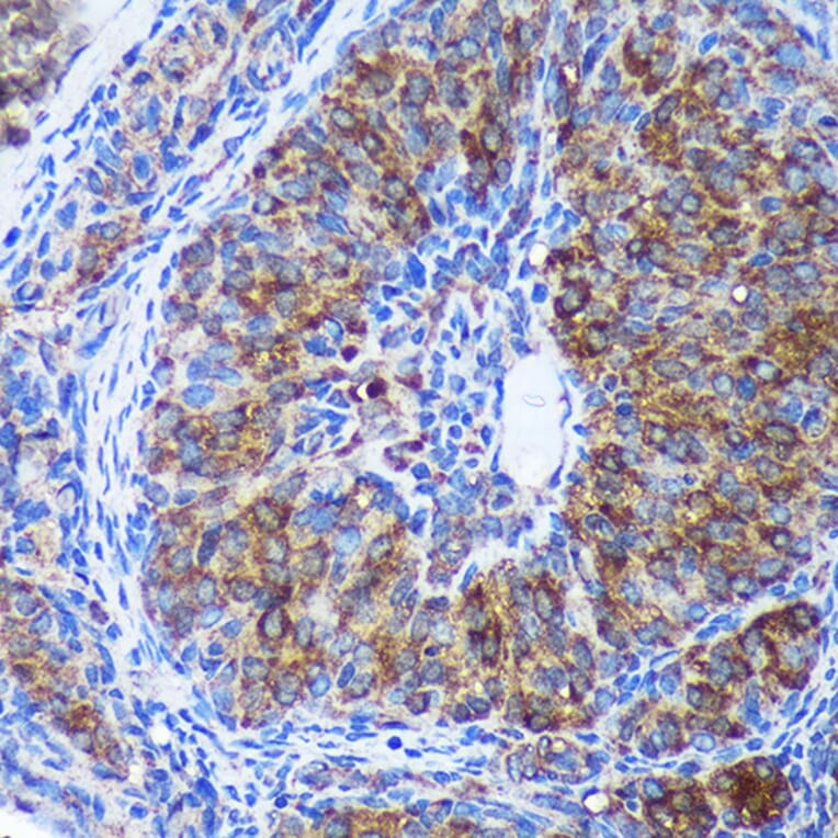 Immunohistochemistry - Anti-GULP Antibody (A89301) - Antibodies.com