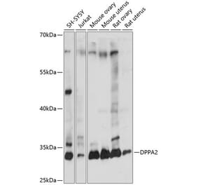 Western Blot - Anti-Dppa2 Antibody (A89302) - Antibodies.com