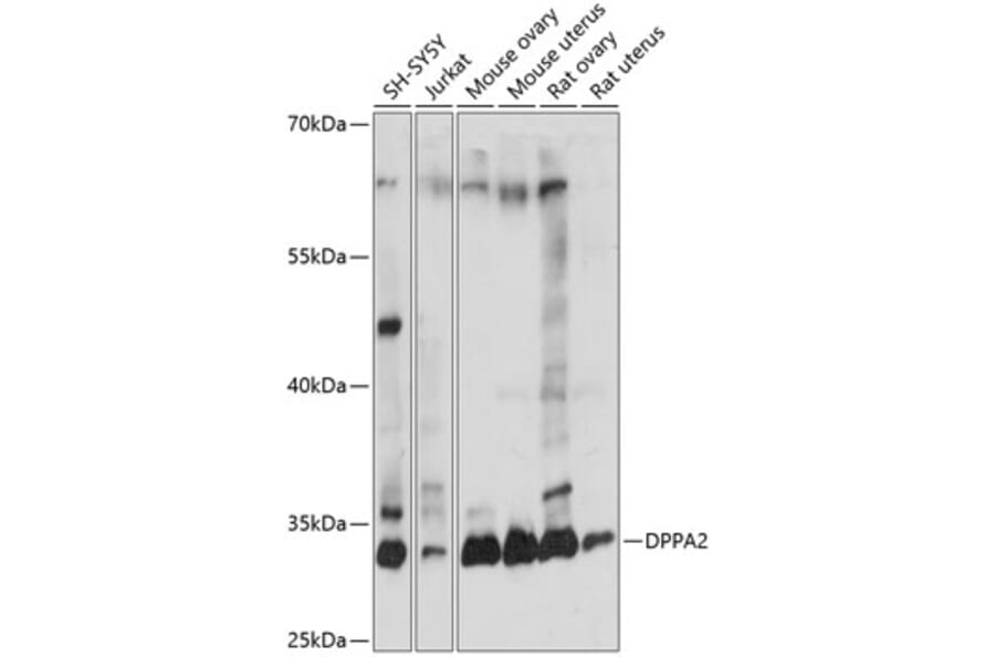 Western Blot - Anti-Dppa2 Antibody (A89302) - Antibodies.com