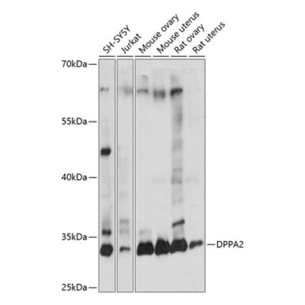 Western Blot - Anti-Dppa2 Antibody (A89302) - Antibodies.com