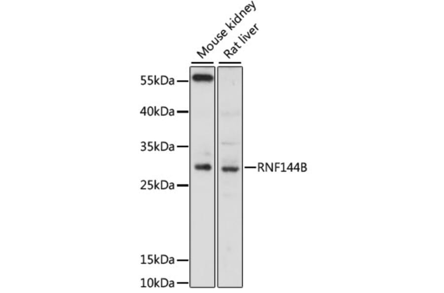 Western Blot - Anti-RNF144B Antibody (A13723) - Antibodies.com