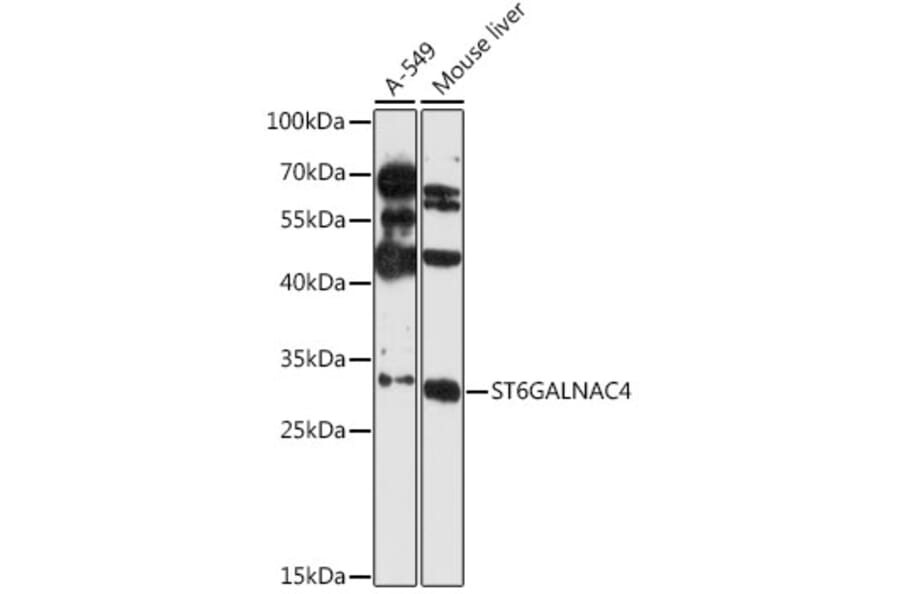 Western Blot - Anti-ST6GALNAC4 Antibody (A89304) - Antibodies.com