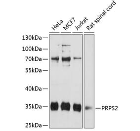 Western Blot - Anti-PRPS2 Antibody (A89305) - Antibodies.com