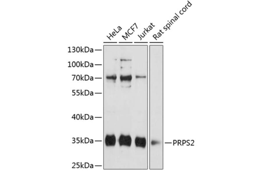 Western Blot - Anti-PRPS2 Antibody (A89305) - Antibodies.com