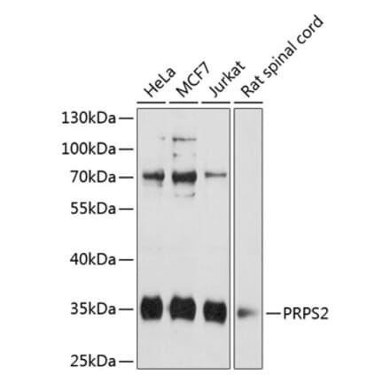 Western Blot - Anti-PRPS2 Antibody (A89305) - Antibodies.com