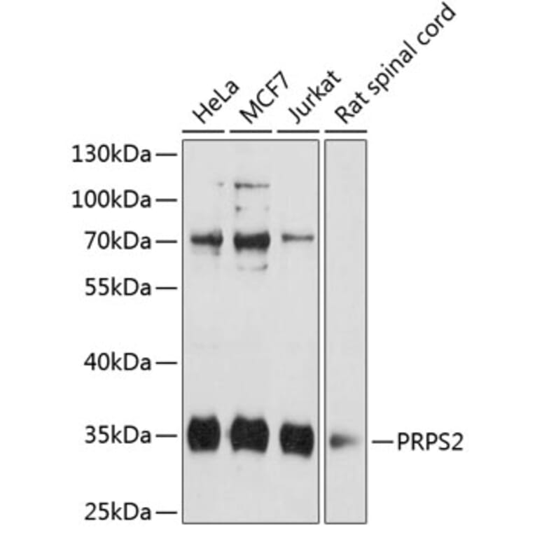 Western Blot - Anti-PRPS2 Antibody (A89305) - Antibodies.com