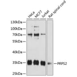 Western Blot - Anti-PRPS2 Antibody (A89305) - Antibodies.com