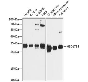 Western Blot - Anti-HSD17B8 Antibody (A89306) - Antibodies.com