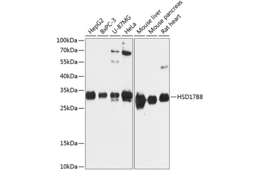 Western Blot - Anti-HSD17B8 Antibody (A89306) - Antibodies.com