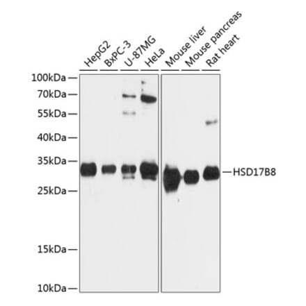 Western Blot - Anti-HSD17B8 Antibody (A89306) - Antibodies.com
