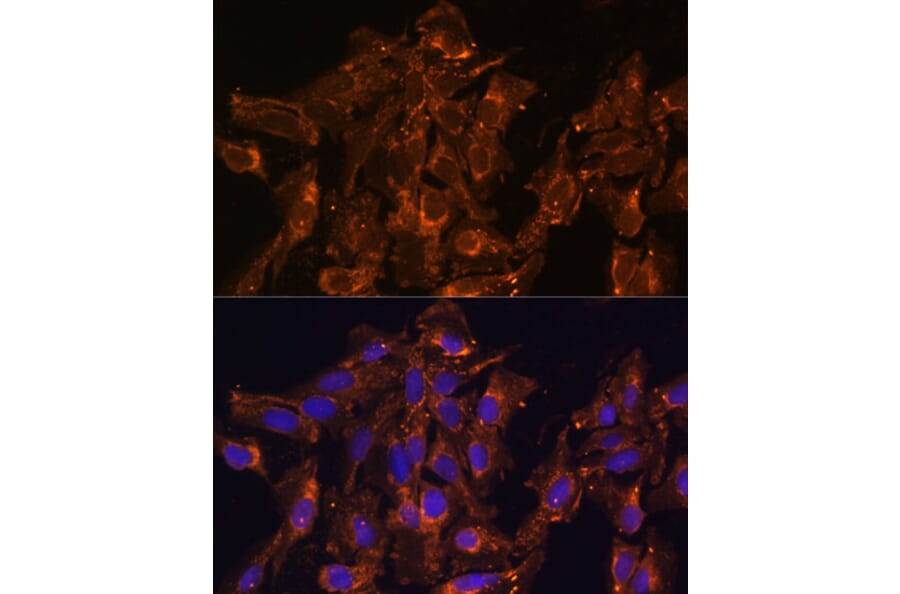 Immunofluorescence - Anti-HSD17B8 Antibody (A89306) - Antibodies.com