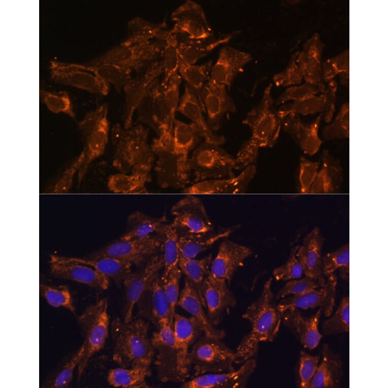 Immunofluorescence - Anti-HSD17B8 Antibody (A89306) - Antibodies.com