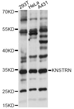 Western blot analysis of extracts of various cell lines, using Anti-KNSTRN Antibody (A14306) at 1:1,000 dilution.
Secondary antibody: Goat Anti-Rabbit IgG (H+L) (HRP) (AS014) at 1:10,000 dilution.
Lysates / proteins: 25µg per lane.
Blocking buffer: 3% non-fat dry milk in TBST.
Detection: ECL Basic Kit (RM00020).
Exposure time: 5s.