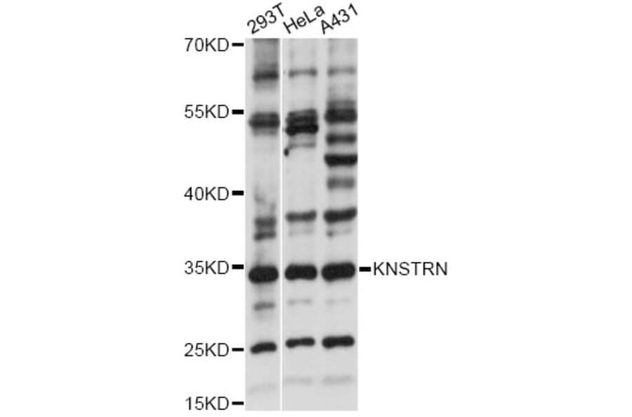 Western Blot - Anti-KNSTRN Antibody (A14306) - Antibodies.com