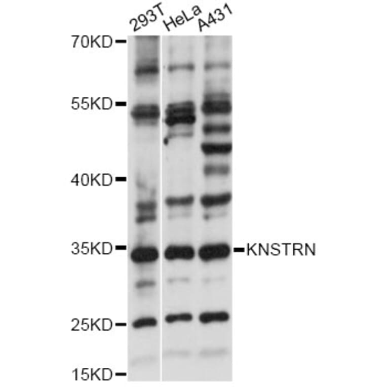 Western Blot - Anti-KNSTRN Antibody (A14306) - Antibodies.com