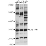 Western Blot - Anti-KNSTRN Antibody (A14306) - Antibodies.com