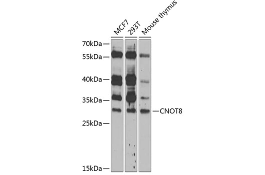 Western Blot - Anti-CNOT8 Antibody (A89308) - Antibodies.com