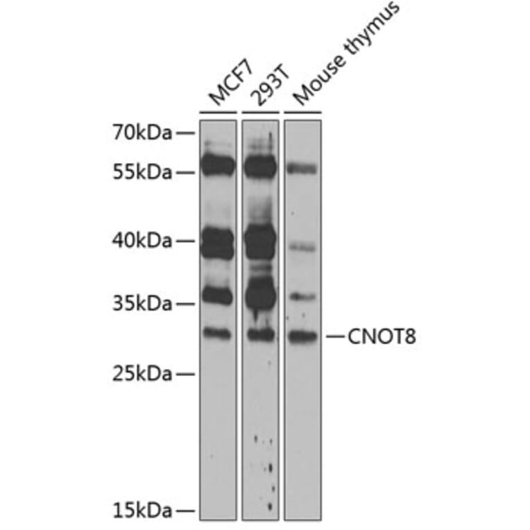 Western Blot - Anti-CNOT8 Antibody (A89308) - Antibodies.com
