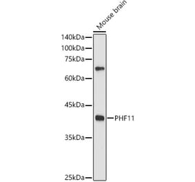 Western Blot - Anti-PHF11 Antibody (A89309) - Antibodies.com