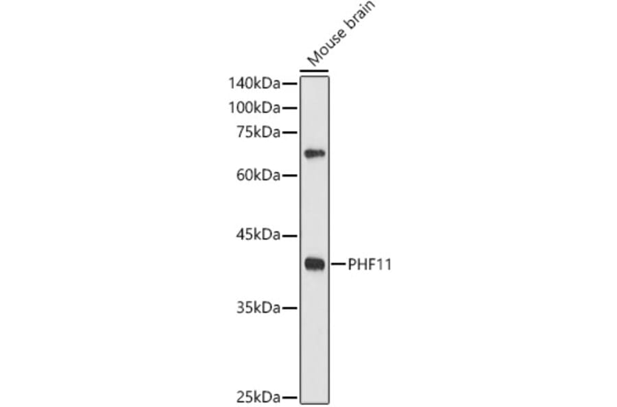 Western Blot - Anti-PHF11 Antibody (A89309) - Antibodies.com