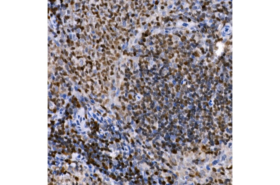 Immunohistochemistry - Anti-PHF11 Antibody (A89309) - Antibodies.com
