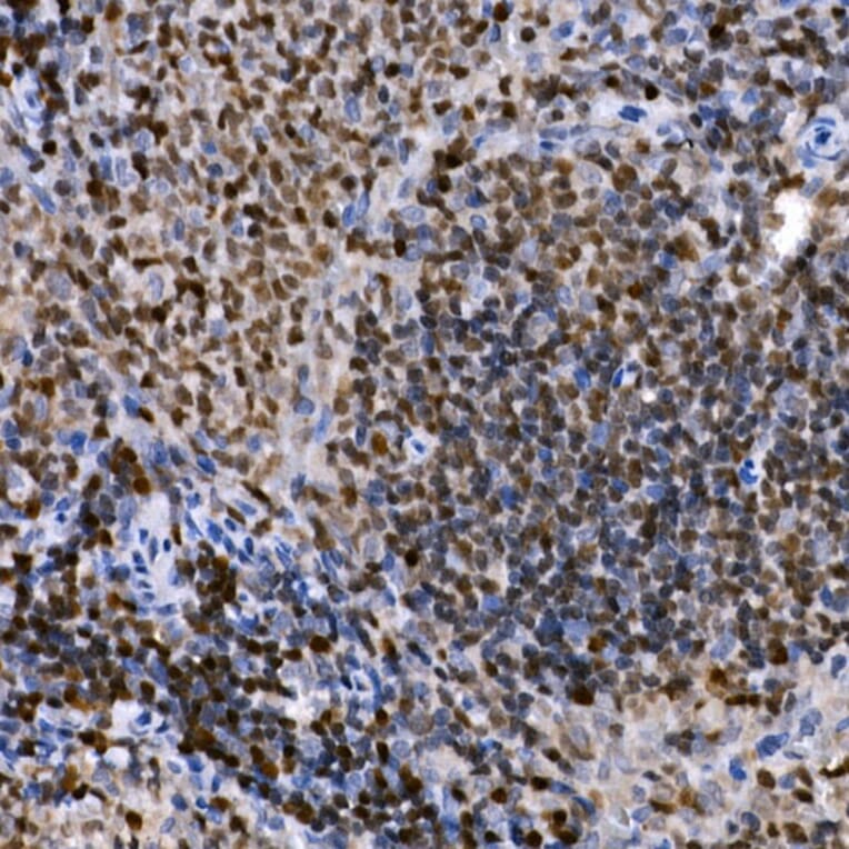 Immunohistochemistry - Anti-PHF11 Antibody (A89309) - Antibodies.com