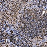 Immunohistochemistry - Anti-PHF11 Antibody (A89309) - Antibodies.com
