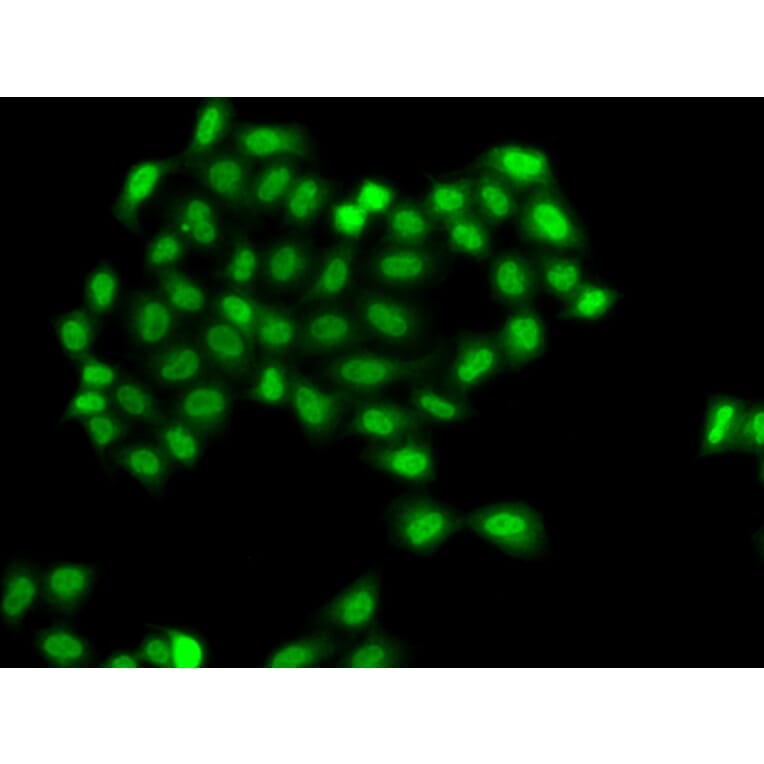 Immunofluorescence - Anti-PHF11 Antibody (A89309) - Antibodies.com