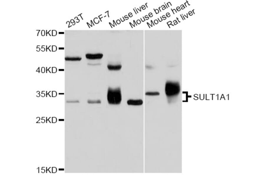 Western Blot - Anti-SULT1A1 Antibody (A12520) - Antibodies.com