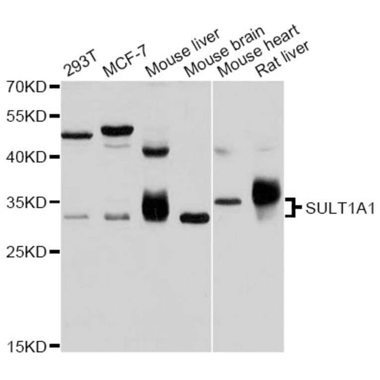 Western Blot - Anti-SULT1A1 Antibody (A12520) - Antibodies.com