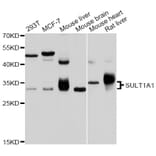 Western Blot - Anti-SULT1A1 Antibody (A12520) - Antibodies.com