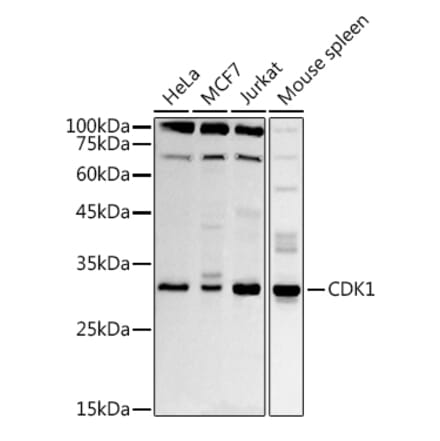 Western Blot - Anti-CDK1 Antibody (A89311) - Antibodies.com