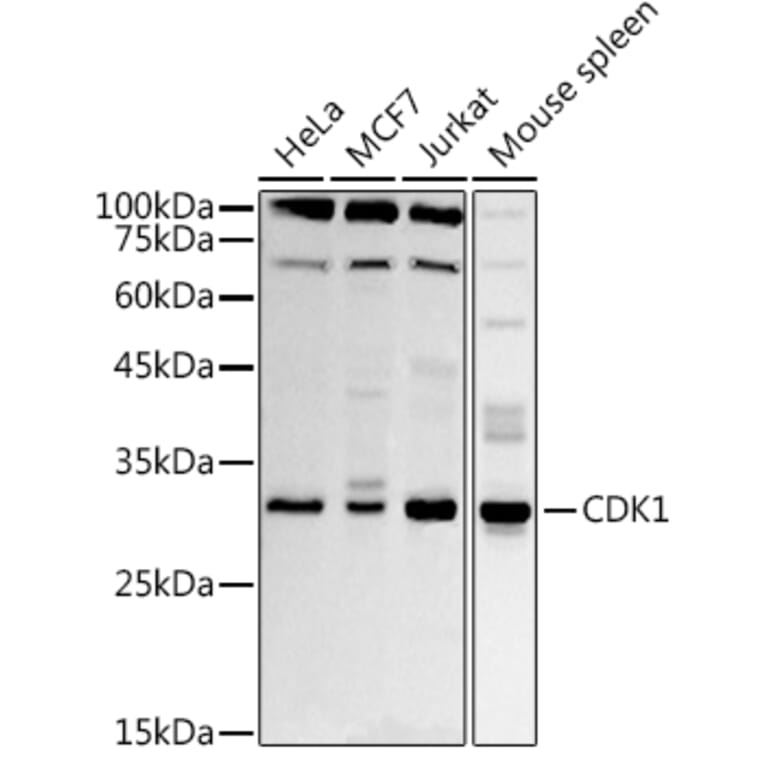 Western Blot - Anti-CDK1 Antibody (A89311) - Antibodies.com
