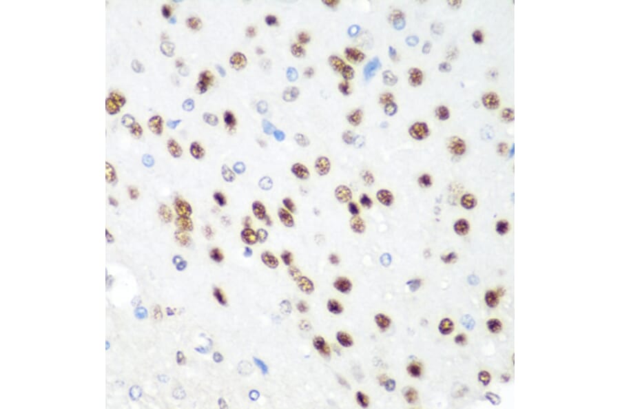 Immunohistochemistry - Anti-CDK1 Antibody (A89311) - Antibodies.com