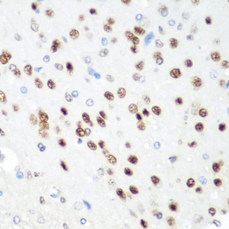Immunohistochemistry - Anti-CDK1 Antibody (A89311) - Antibodies.com