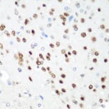 Immunohistochemistry - Anti-CDK1 Antibody (A89311) - Antibodies.com