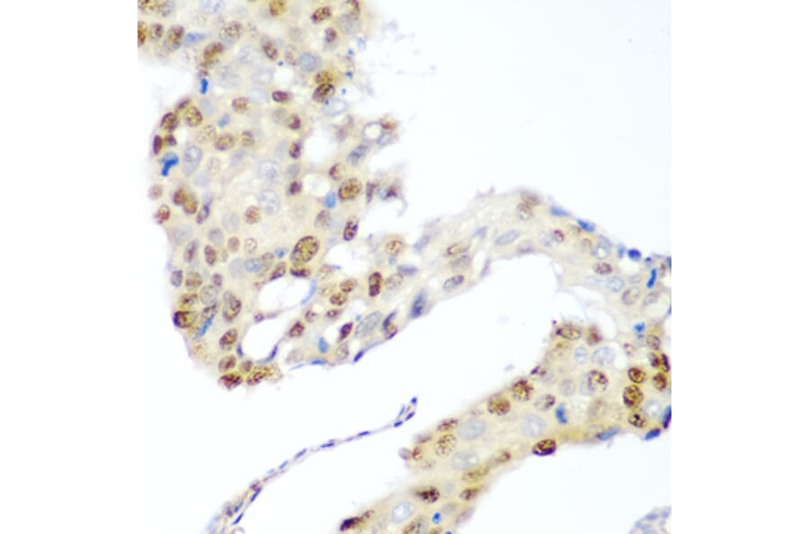 Immunohistochemistry - Anti-CDK1 Antibody (A89311) - Antibodies.com
