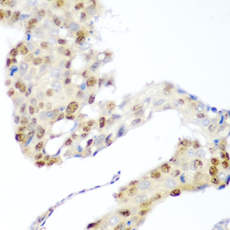 Immunohistochemistry - Anti-CDK1 Antibody (A89311) - Antibodies.com