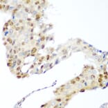 Immunohistochemistry - Anti-CDK1 Antibody (A89311) - Antibodies.com