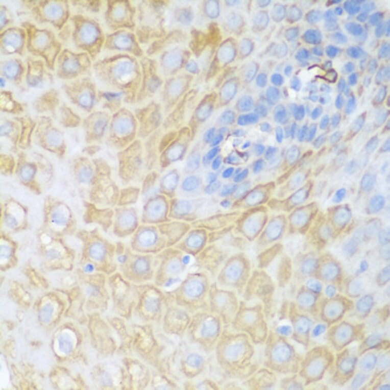Immunohistochemistry - Anti-CDK1 Antibody (A89311) - Antibodies.com