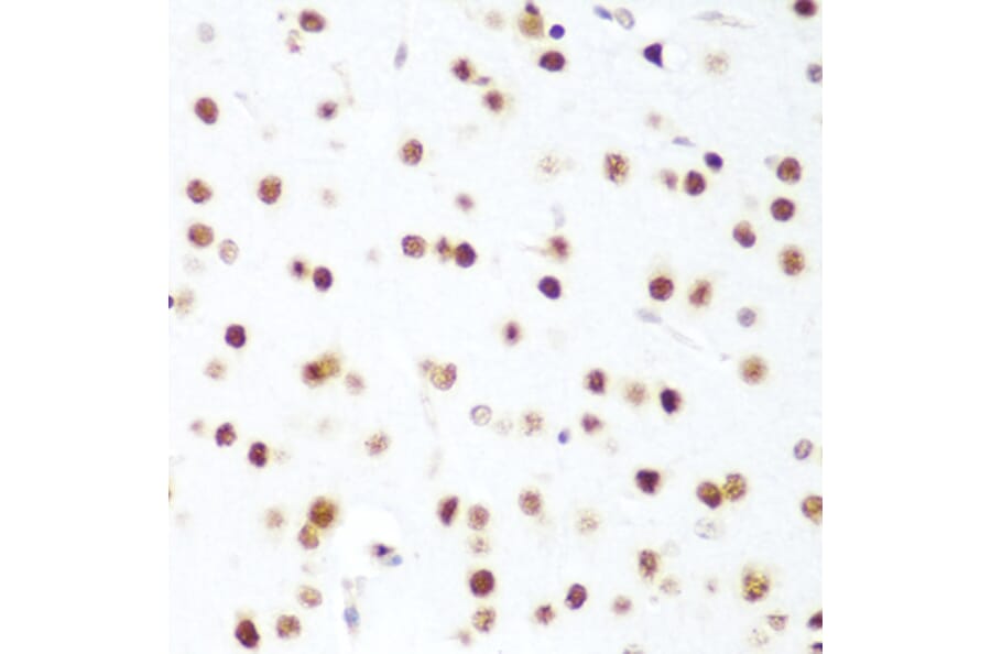 Immunohistochemistry - Anti-CDK1 Antibody (A89311) - Antibodies.com