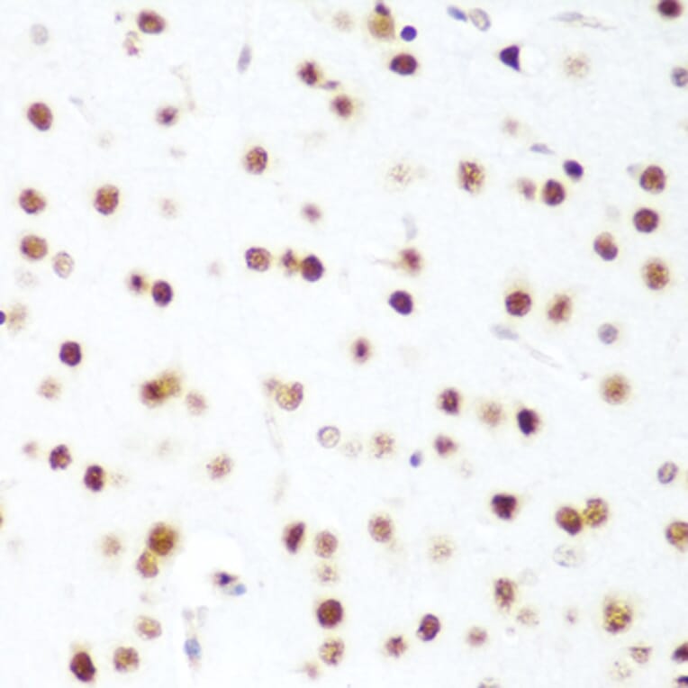 Immunohistochemistry - Anti-CDK1 Antibody (A89311) - Antibodies.com