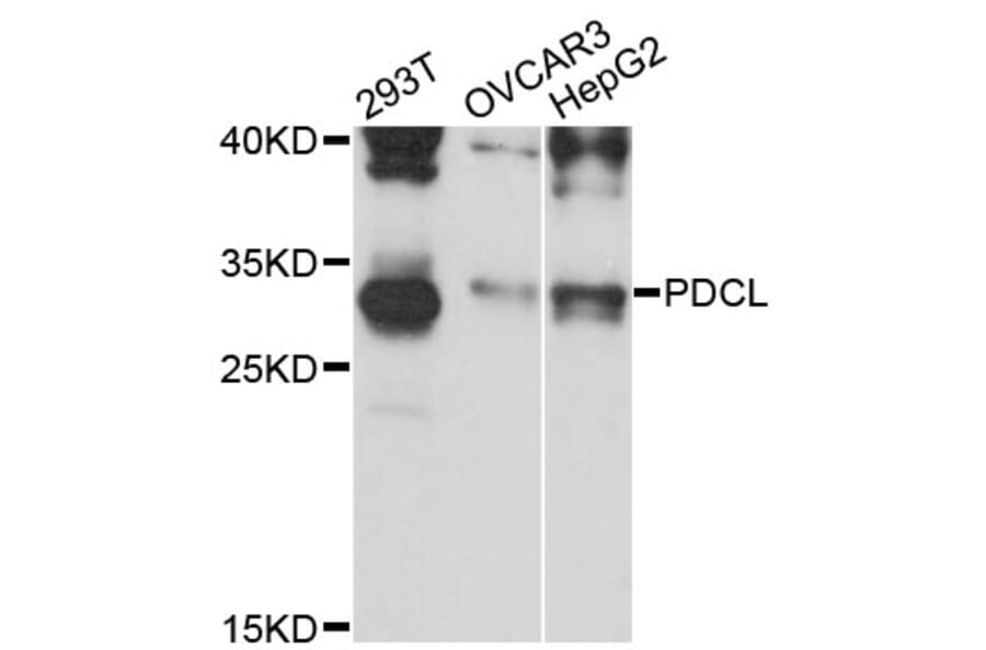 Western Blot - Anti-PDCL Antibody (A13722) - Antibodies.com