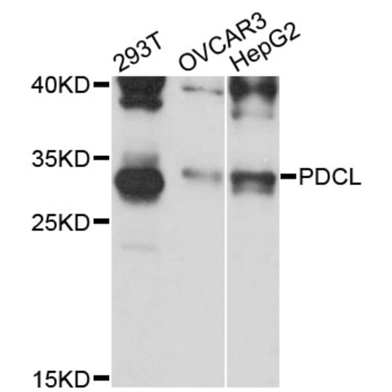 Western Blot - Anti-PDCL Antibody (A13722) - Antibodies.com