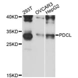 Western Blot - Anti-PDCL Antibody (A13722) - Antibodies.com
