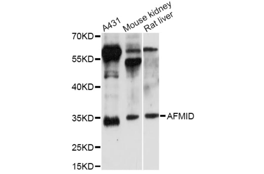 Western Blot - Anti-AFMID Antibody (A14441) - Antibodies.com