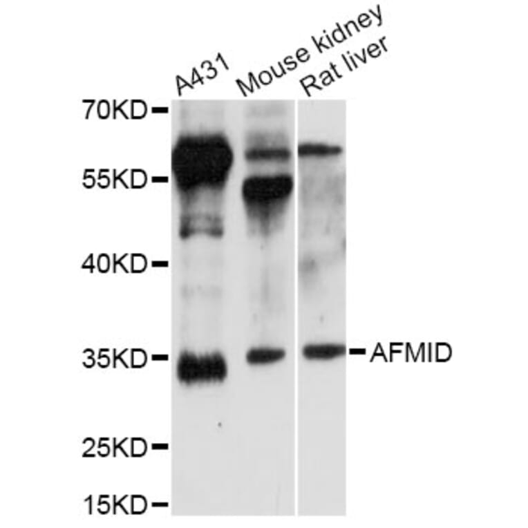 Western Blot - Anti-AFMID Antibody (A14441) - Antibodies.com