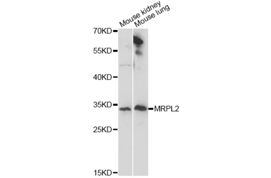 Western Blot - Anti-MRPL2 Antibody (A14404) - Antibodies.com
