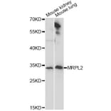 Western Blot - Anti-MRPL2 Antibody (A14404) - Antibodies.com