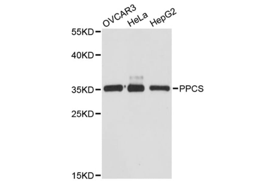 Western Blot - Anti-PPCS Antibody (A12828) - Antibodies.com